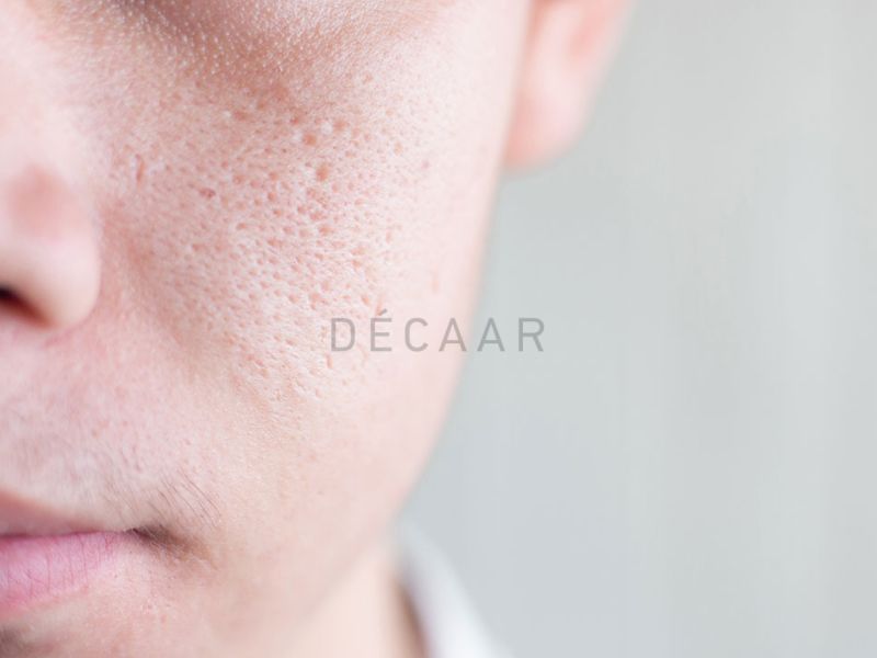 cách giảm dầu da mặt